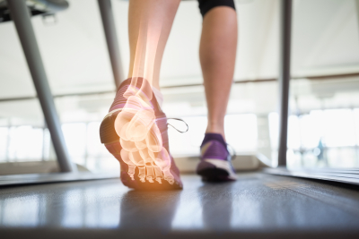 digital composite of highlighted foot bones of jogging woman